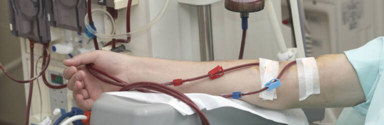 dialysis health care medicine kidney